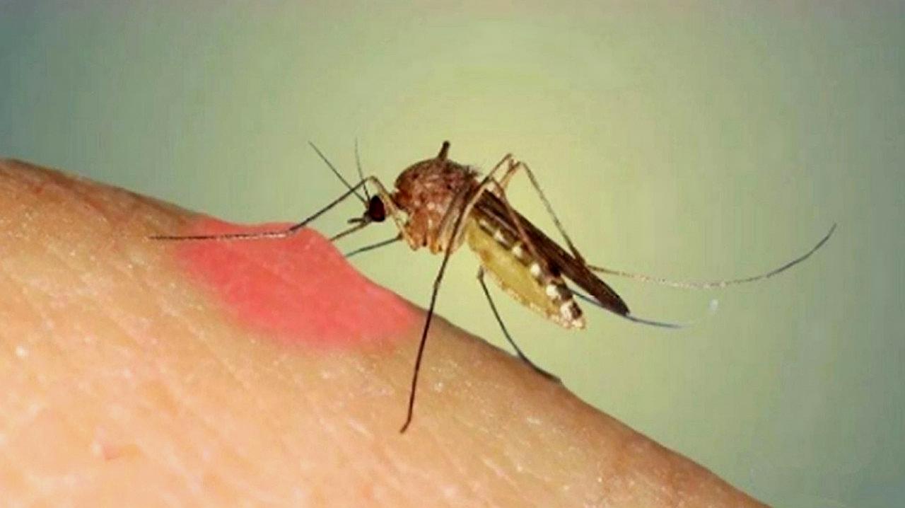 蚊子应该怎么驱除?