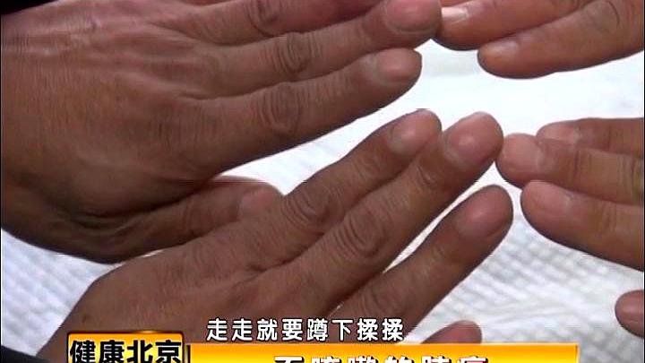杵状指相关鉴别诊断,手指长这样,可能是肺癌的早期征兆
