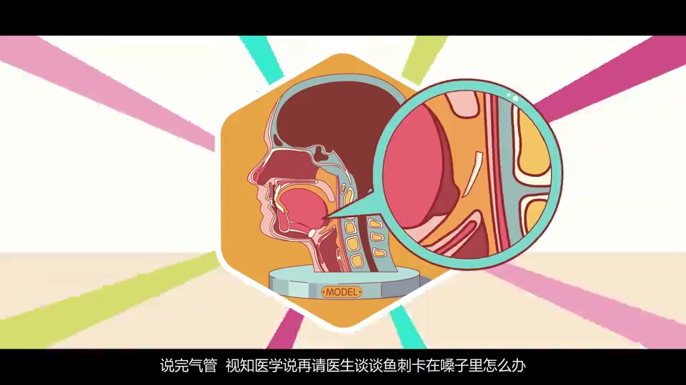 喉咙卡了鱼刺怎么办?